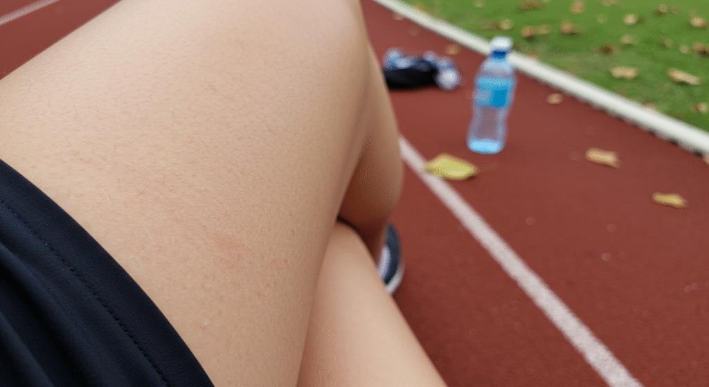 Bolesne obtarcie uda po bieganiu to problem, który potrafi zepsuć nawet najlepszy trening i zniechęcić do aktywności. Przyczyną jest tarcie, potęgowane przez wilgoć i źle dobraną odzież. Na szczęście istnieją proste i skuteczne sposoby, by temu zapobiec. Przeczytaj, jak chronić skórę i co robić, gdy pojawi się podrażnienie.